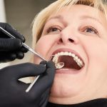 Что такое виниры для зубов и как они крепятся