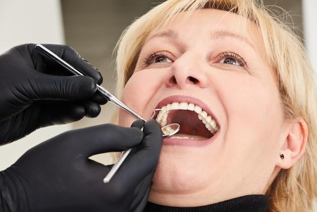 НГДоктор | Что такое виниры для зубов и как они крепятся